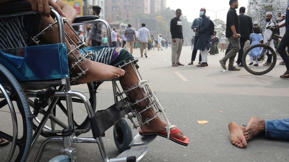 জুলাই অভ্যুত্থানে আহতরা সুচিকিৎসা ও পুনর্বাসনের দাবিতে রবিবার দিনভর ঢাকার শ্যামলীর সড়কে অবস্থান নিয়ে বিক্ষোভ দেখায়। ছবি : সকাল সন্ধ্যা